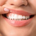 Relación entre Enfermedad Periodontal y Enfermedad Coronaria