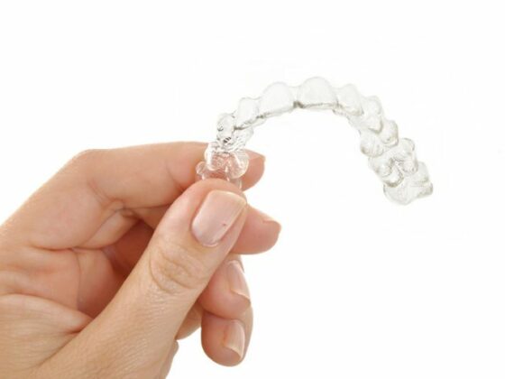 Cómo cuidar los alineadores Invisalign | Clínica Maestro