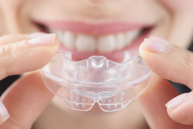 Ventajas de usar protectores bucales deportivos - Clínica Basu - Dentistas